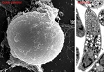 Investigación contra la toxoplasmosis.