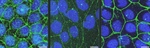 La proteína ZO-2 de las uniones estrechas actúa como sensor de la tensión mecánica en las células epiteliales