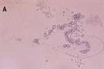 Efecto nematicida del extracto de Canavalia ensiformis y su potencialización con nanopartículas contra Meloidogyne incognita