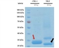 Tepary Bean (Phaseolus acutifolius) Lectins as Modulators of Intracellular Calcium Mobilization in Breast Cancer and Normal Breast Cells