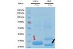 Tepary Bean (Phaseolus acutifolius) Lectins as Modulators of Intracellular Calcium Mobilization in Breast Cancer and Normal Breast Cells