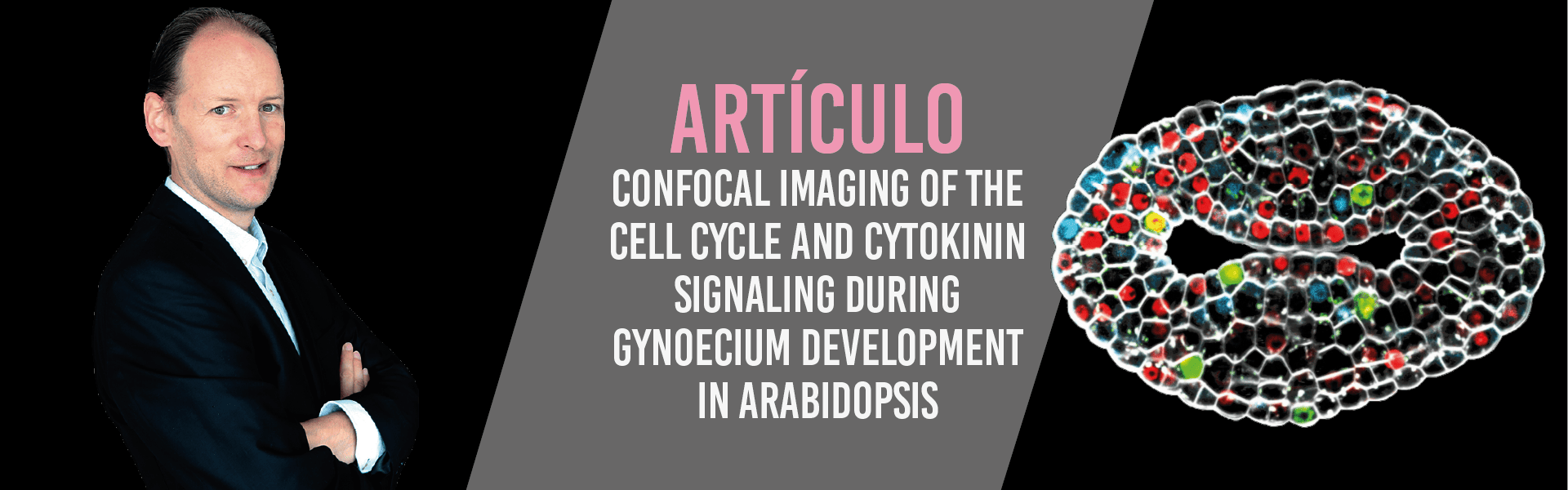 Confocal imaging of the cell cycle and cytokinin signaling during gynoecium development in Arabidopsis