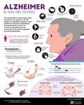 Alzheimer, el mal del olvido