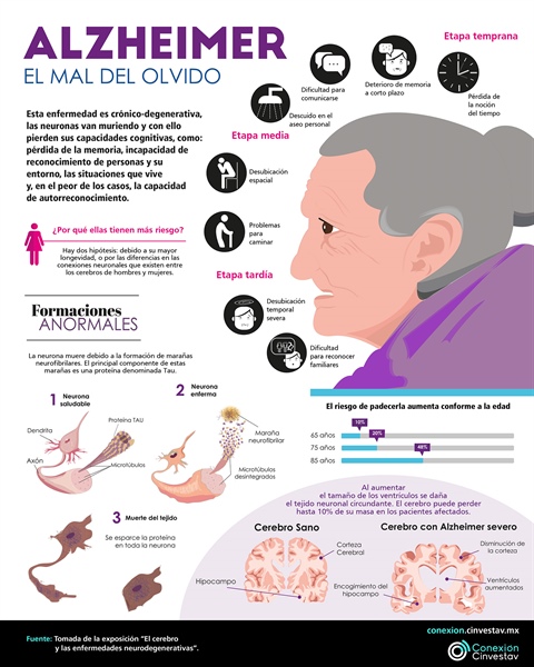 Alzheimer, el mal del olvido