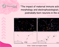 Emilio J. Galván - The impact of maternal immune activation on the morphology and electrophysiological properties of postnatally-born neurons in the offspring.